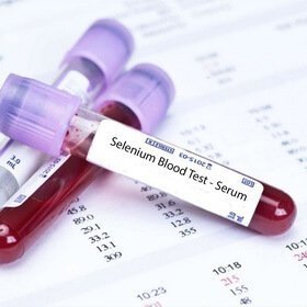 Анализ крови на селен